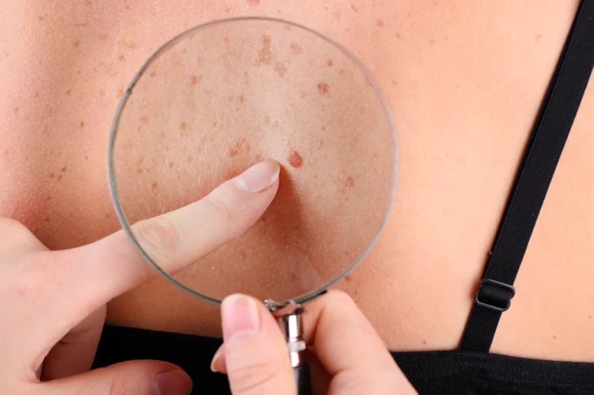 Dermatološki pregled